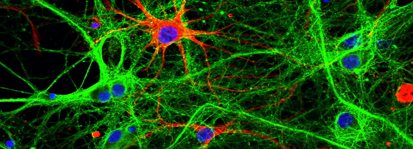 Scopri di più sull'articolo Workshop “Nanobodies for whole brain imaging and human studies”_Roma, 29 ottobre 2025